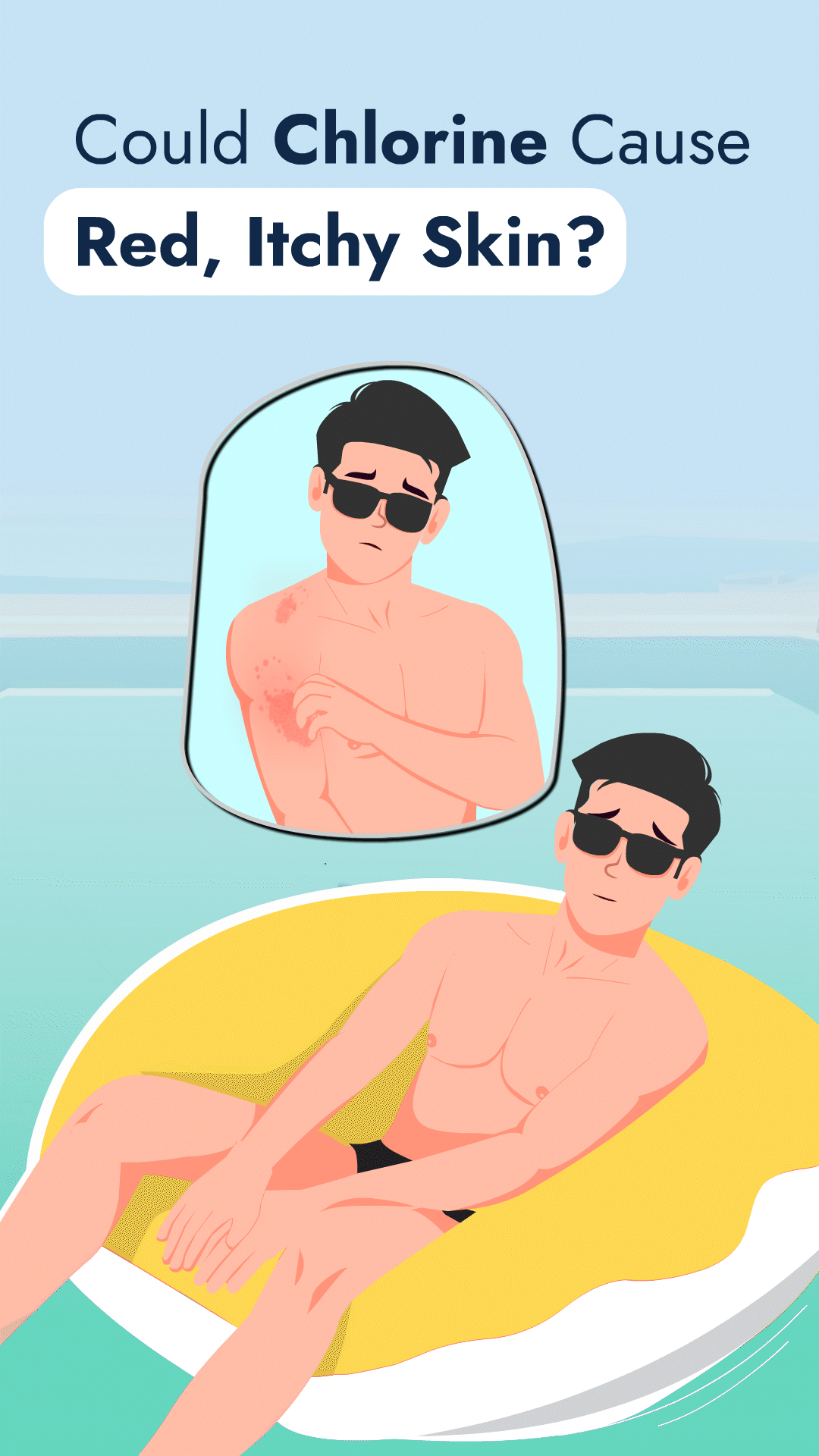 Swimmer's Itch?