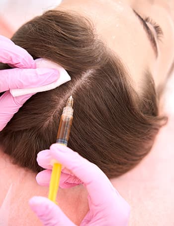 What is PRP Hair Treatment?