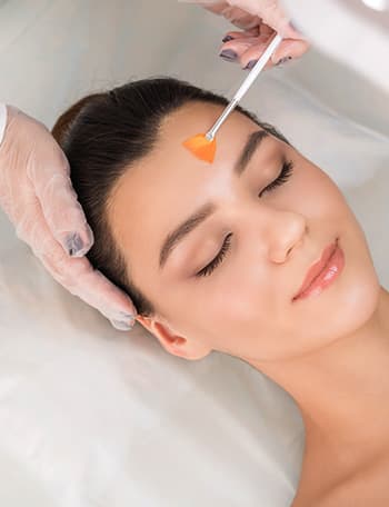 Salicylic Acid Peels for Stubborn Acne